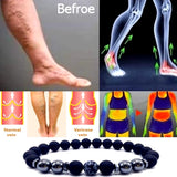 Magnet Anklet Colorful Stone Eight Loss Magnetic Therapy Bracelet Weight Loss Product Slimming Health Care Jewelry