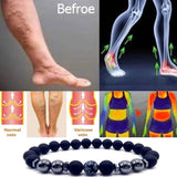 Magnetic Anklet Brazilian Black Stone Loss Magnetic Therapy Bracelet Weight Loss Product Slimming Health Care Jewelry